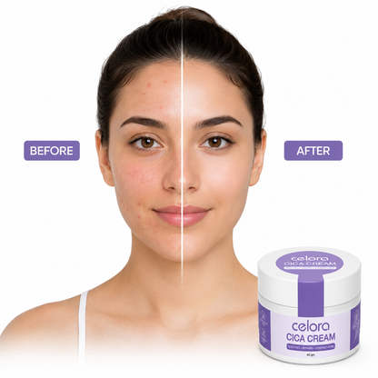 Celora Cica cream  60 ml